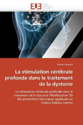 La stimulation cérébrale profonde dans le traitement de la dystonie