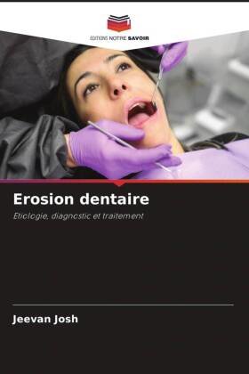 Erosion dentaire